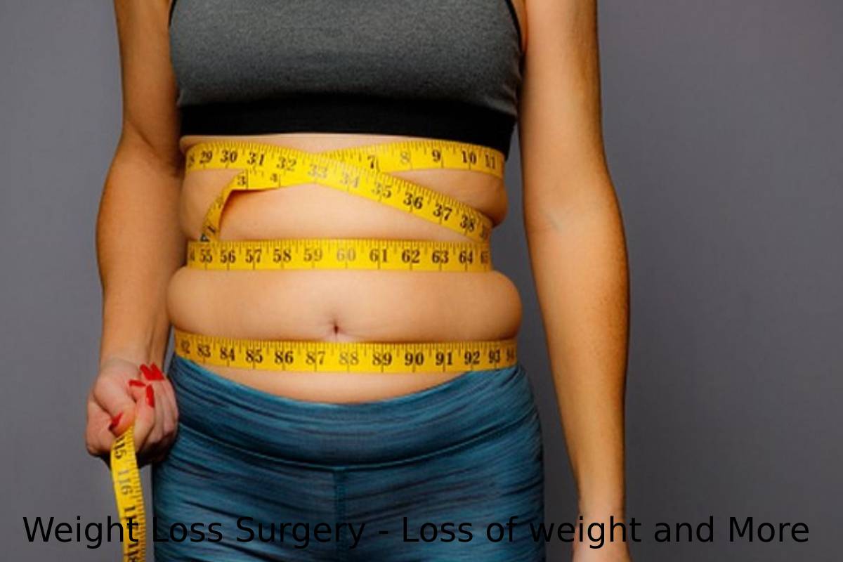 Weight Loss Surgery - Loss of weight and More